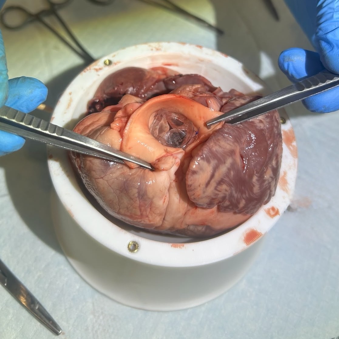 CALIX Cardiac Cup in use during valve training